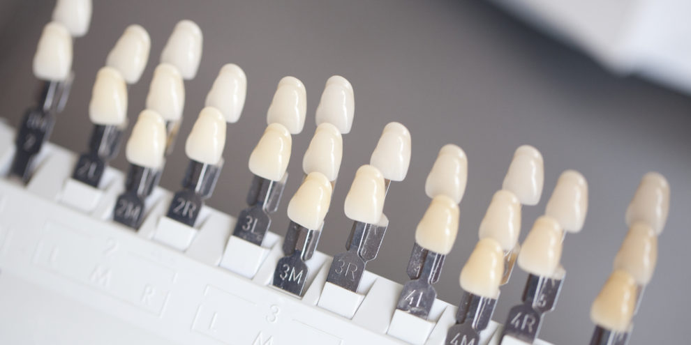 blanchement dentaire dentiste colombes