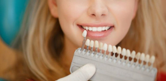 blanchiment dentaire dentiste colombes dentiste paris blanchiment dentaire dentiste colombes dentiste paris