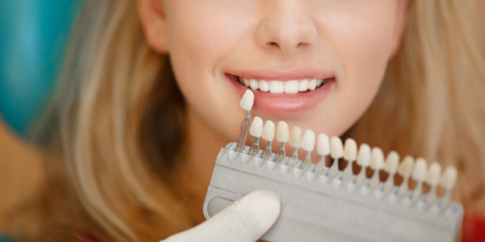 blanchiment dentaire dentiste colombes dentiste paris