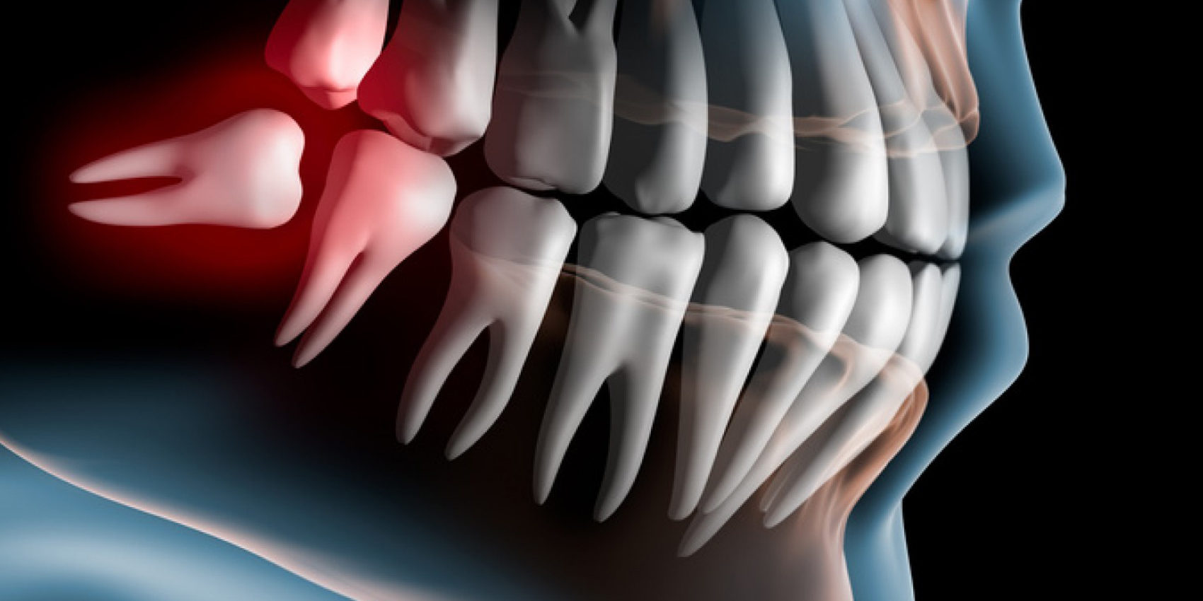 Healthy teeth patient at dentist office