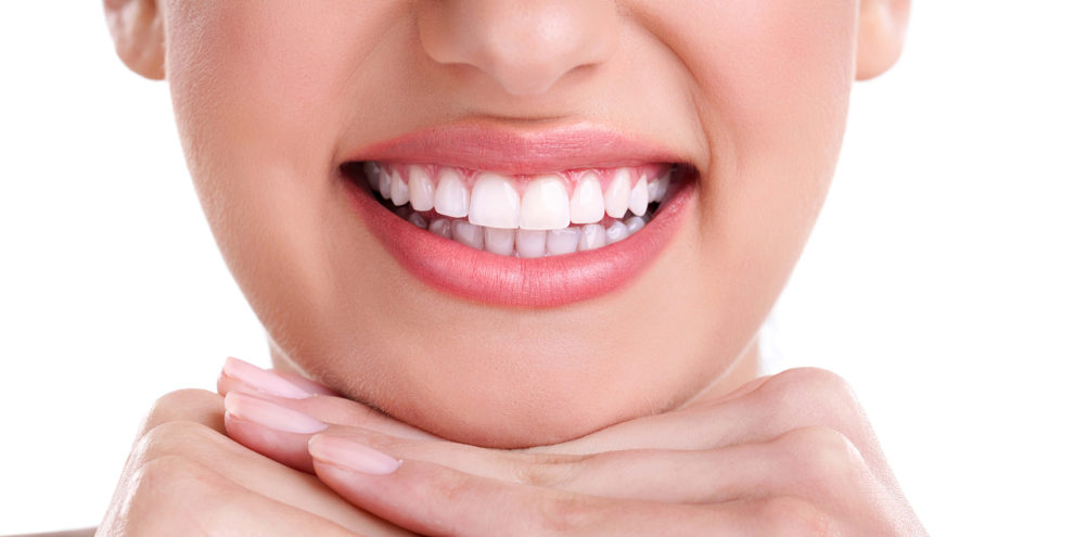 facettes dentiste colombes